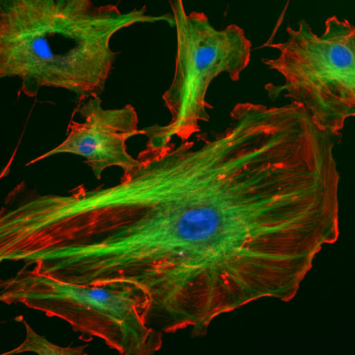 fluoreszierende Cytoskelette in Rinder-Endothelzellen