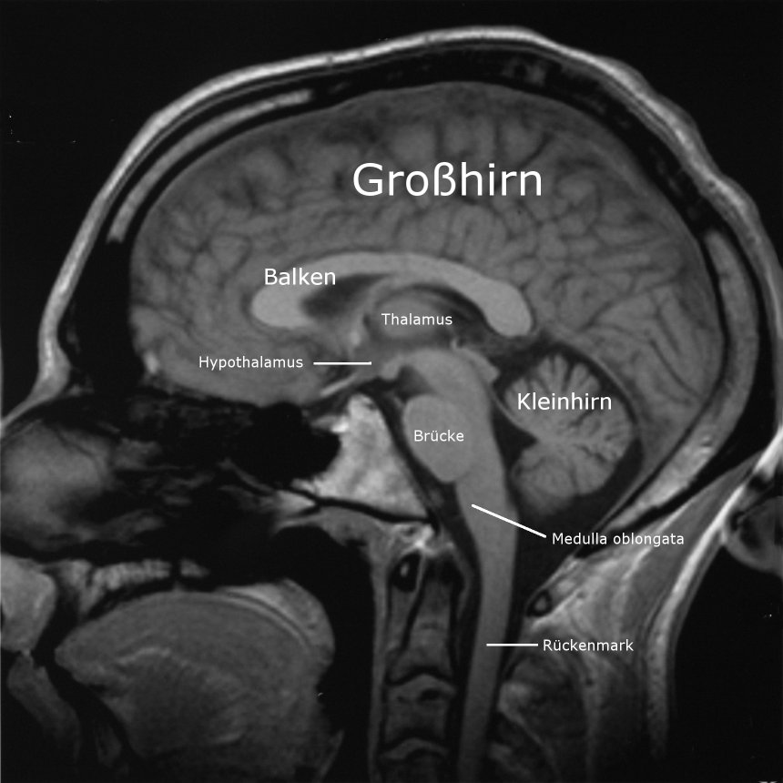 MRT-Bild eines menschlichen Gehirns