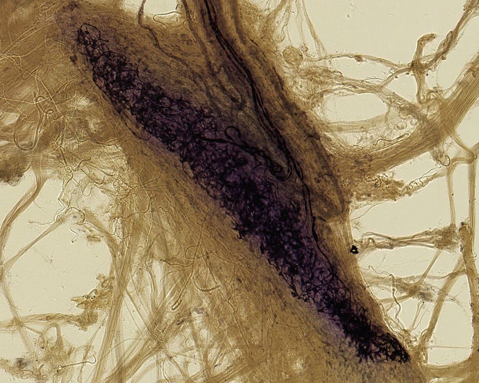 Ruffini Corpuscle by Angelo Ruffini